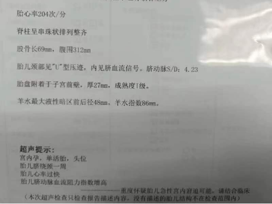 2023-09-21_分秒必争！我院成功抢救一例“胎心异常”危重孕产妇，母女平安！_6.jpg